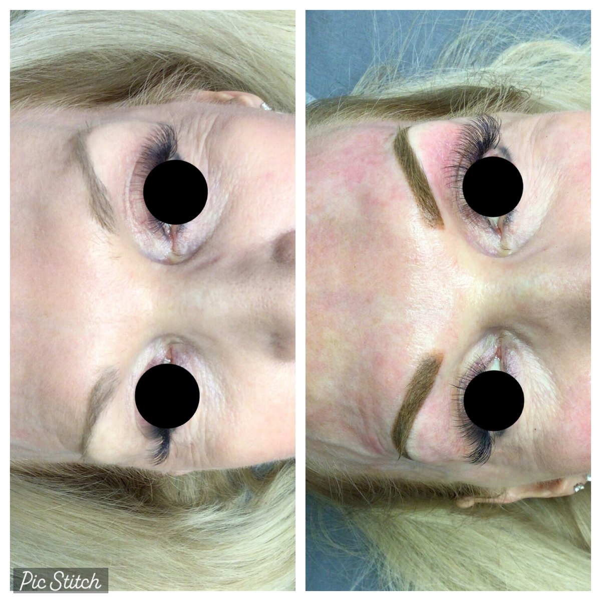 ParksDermatolog's tweet image. An ombre eyebrow is a semi-permanent tattoo that appears as a soft shaded brow pencil look. **Results do vary based on lifestyle and skin type,** but usually can last on average up to 2-3 years. Call now to book a consultation! 📞👉 (386) 677-9044 #ombrebrows #semipermanentbrows