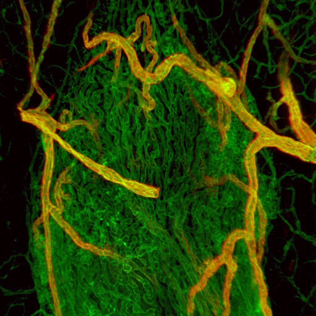 Neurobiology Imaging Facility at Harvard Medical (@hms_nif) on Twitter photo #FluorescenceFriday image by @urs_langen, <a href="/GuLabNeuro/">The Gu Lab</a> <a href="/harvardmed/">Harvard Medical School</a> - red blood cells (green) in brain capillary (red)
Image was acquired on a <a href="/LeicaMicro/">Leica Microsystems</a> #SP8 confocal and processed using <a href="/ImarisSoftware/">Imaris 3D/4D Imaging</a> #FluorescenceFriday image by @urs_langen, <a href="/GuLabNeuro/">The Gu Lab</a> <a href="/harvardmed/">Harvard Medical School</a> - red blood cells (green) in brain capillary (red)
Image was acquired on a <a href="/LeicaMicro/">Leica Microsystems</a> #SP8 confocal and processed using <a href="/ImarisSoftware/">Imaris 3D/4D Imaging</a>