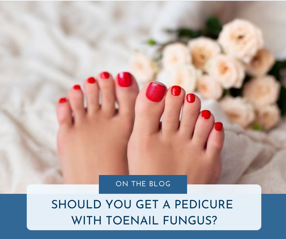 You might want to get a pedicure so your feet look their best, but are worried about a potential fungal infection and how this will affect the results of your pedicure. Read on to find out more.💅🏼bit.ly/3jUAAqI

#healthblog #healthbloggers #footfungus #pedicure #health
