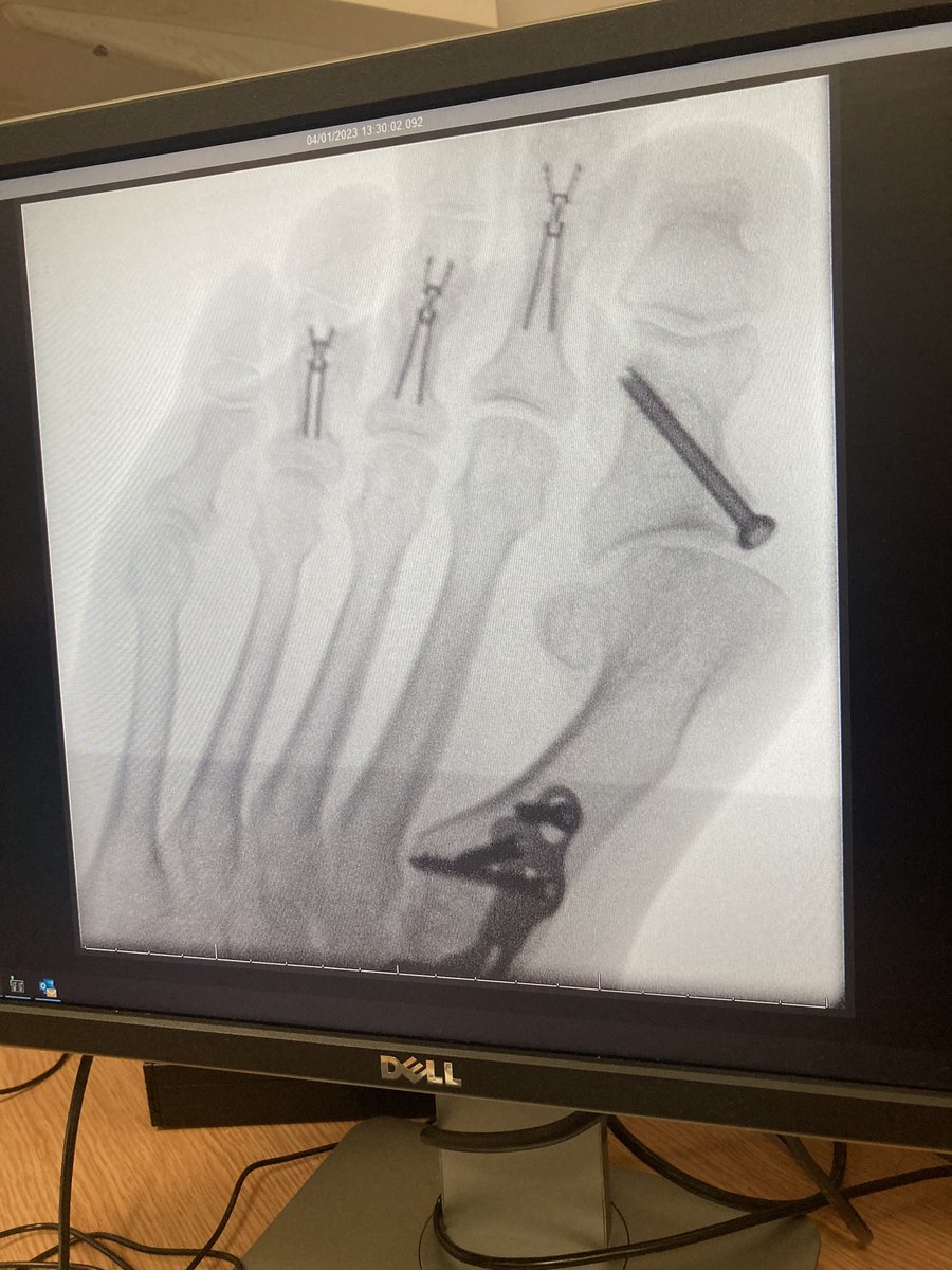 jkd123's tweet photo. St George’s Hospital, I’m grateful to the consultants.!! https://t.co/anG21yYz4u
