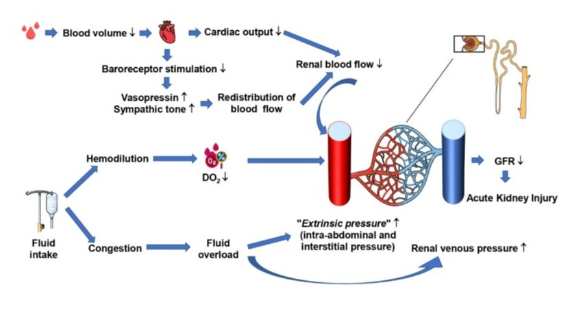 nicolas_fage's tweet photo. Quel est l'effet de la noradrénaline et/ou de la vasopressine sur le rein au cours de l'état de choc hémorragique ? effet bénéfique ou délétère ?
Mini revue dans International Journal of Molecular Science 
https://t.co/rmtuzCsnXO
@La_SRLF @JeunesSRLF @com_SFNDT @chu_angers https://t.co/b4dFJYlATi