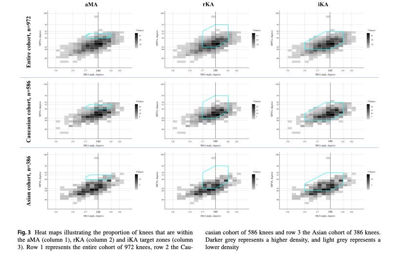 PhilipWdG's tweet photo. PROUD ON THIS ONE 🔬 
Our 4th paper on #iKA published this week in @KSSTA "iKA accommodates native coronal knee alignment better in comparison to aMA and rKA" 
Link: https://t.co/nNlx4d4XDz @OrthoRoeselare @kurclaeys @Tamayavc @KULeuvenBrugge @az_delta https://t.co/8zo1HZsdud