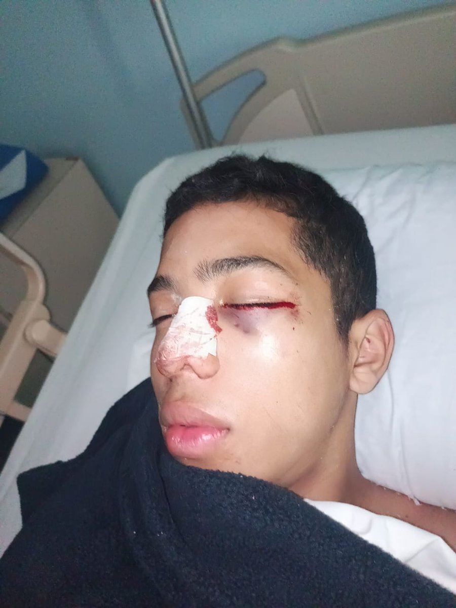 Nostrum10's tweet photo. Agresión brutal a mi sobrino en su liceo por no dejarse lanzar pedazos de arepa durante el receso. Le causaron fracturas en el rostro dos estudiantes de otro curso, uno lo toma del cuello mientras el otro lo golpea
@TarekWiliamSaab @MinpublicoVEN @MPPEDUCACION @_LaAvanzadora https://t.co/FZvtapk5SD