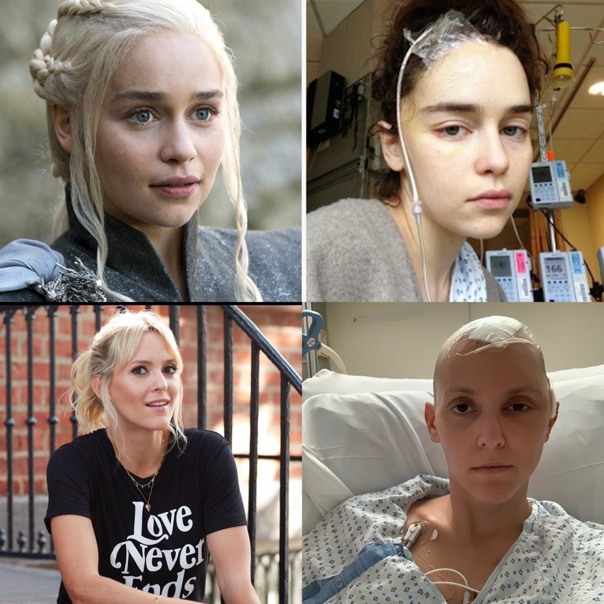 Emilia &amp; I are some of the lucky ones. We survived. But the lack of neuro-rehab/long-term care make survival bleak. We are v proud of the incredible work that @SameYouOrg are doing for #braininjury. Thanks to a generous donor if you donate TODAY yr donation will be 100% matched🙏