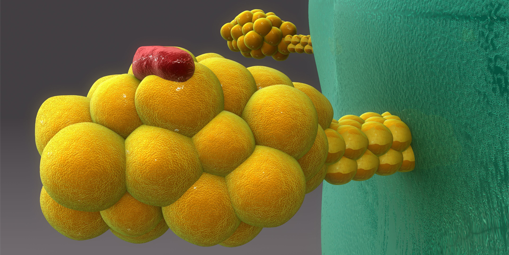 CD_AACR's tweet photo. Cancer Discovery #ResearchWatch:
Noncanonical Splice Junctions Encode Immunogenic Tumor Neoantigens, summarizing the complementary papers by @MarianneBurbage, Ares Rocañín-Arjó, @AntoMerlotti, Benjamin Sadacca, @YagoArribas @JoshWaterfall @Sebasti92658716 @institut_curie @Inserm https://t.co/WzFcMXUqlB