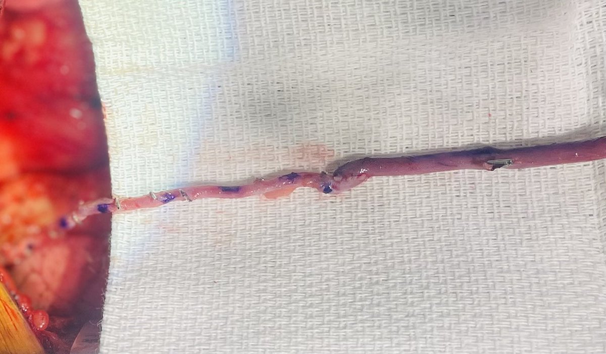 Gianluca Torregrossa tweet media