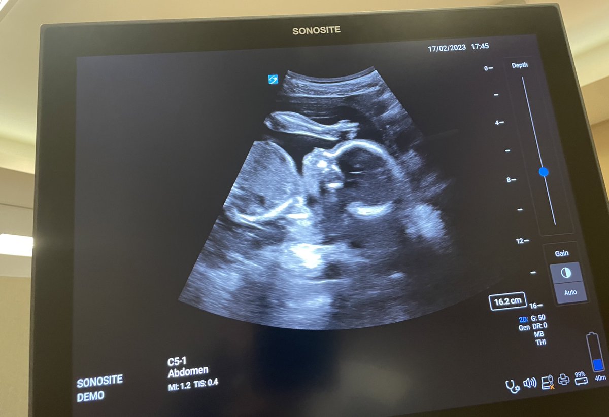 What a great day! Thank you to excellent teaching faculty, live models, delegates &amp; our sponsors for helping us deliver the course! An emotional day for me as I move onto another chapter after 6 fab years with @bursturology - thank you team for my👌🥰leaving card and prezzie ❤️