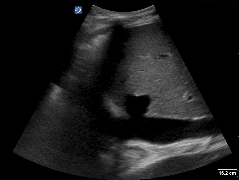 Ahmed t abdellah on twitter pocus pt w o h o hfref 30 ckd3