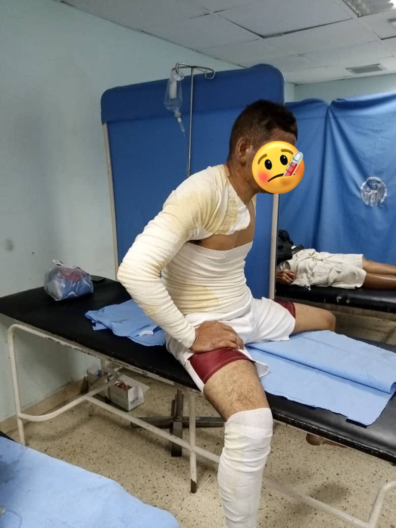 AlexaGomezDos's tweet photo. Buenas noches. El día 10 de febrero, una bombona de gas explotó en una casa en San Félix,dejando a 3 personas quemadas, entre ellos a una niña de 5 años. Están en el Hosp. Ruiz y Páez unidad de quemados. Necesitan alb��mina y muchos insumos. Con Bs.20 podríamos apoyarlos🙏🏼Gracias https://t.co/SG9hiVuYHW