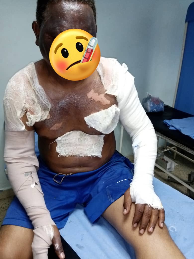 AlexaGomezDos's tweet photo. Buenas noches. El día 10 de febrero, una bombona de gas explotó en una casa en San Félix,dejando a 3 personas quemadas, entre ellos a una niña de 5 años. Están en el Hosp. Ruiz y Páez unidad de quemados. Necesitan alb��mina y muchos insumos. Con Bs.20 podríamos apoyarlos🙏🏼Gracias https://t.co/SG9hiVuYHW