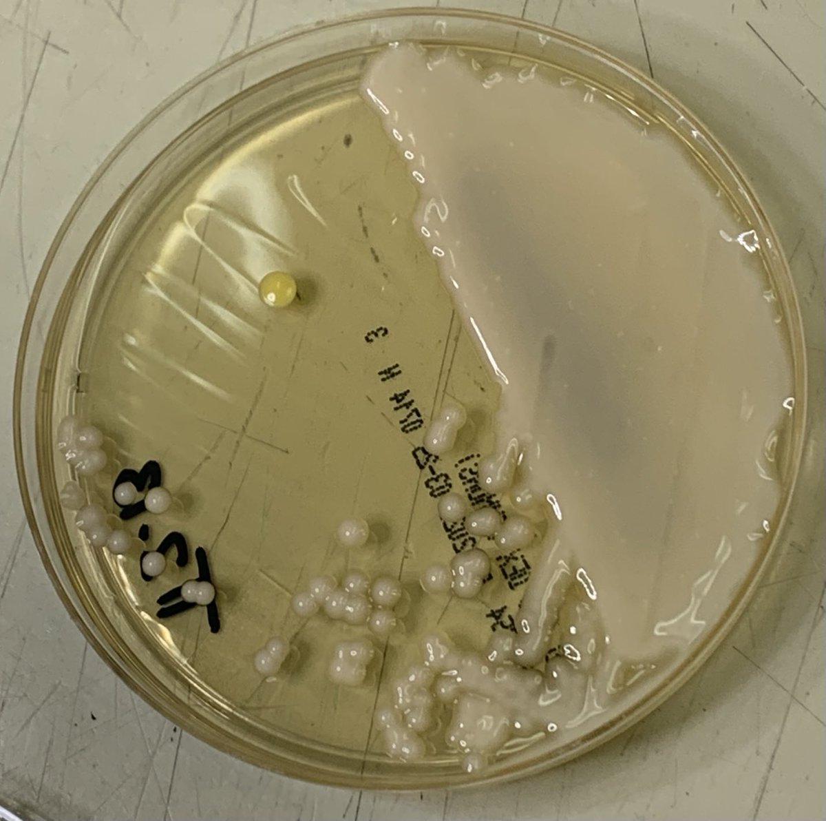 Micro/Path rounds #cryptococcus   BAL… nice capsule 🔬 creamy, mucoid colonies 🧫 #IDFellowship #microbiology #IDTwitter