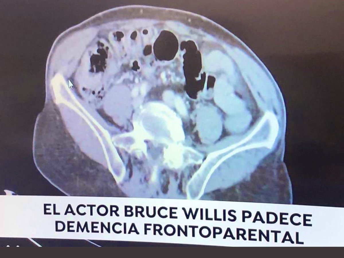 Lorenzo Fácila tweet media