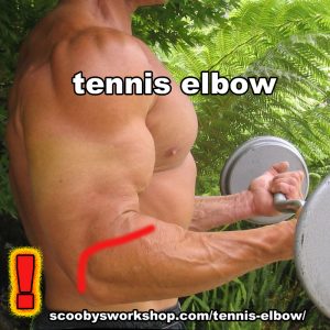 How to cure Tennis Elbow. #fitnesstyle #inspiringfitness #veganbodybuilding bit.ly/2UEcHlg