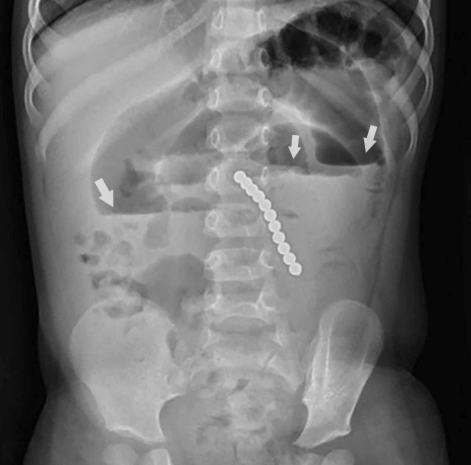 radRounds Radiology Network tweet media