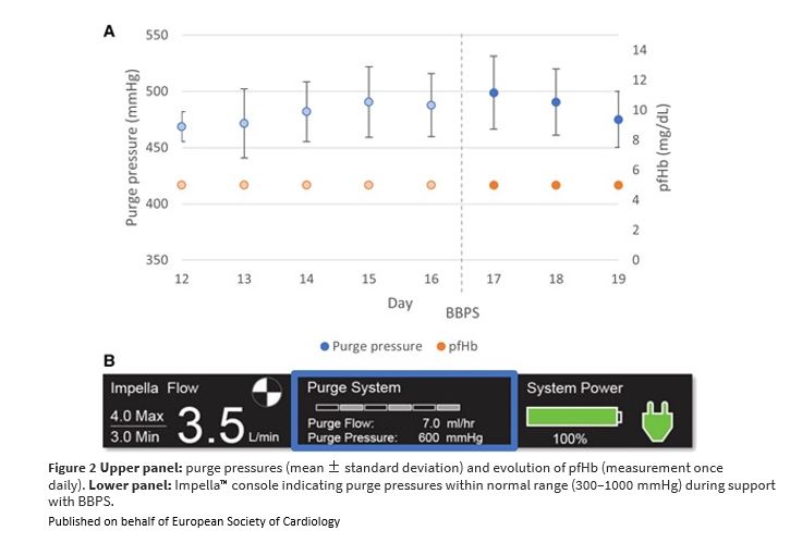ESC_Journals's tweet image. #CathLabHack: Switch to a bicarbonate-based Impella CP™ purge solution in a patient with haemothorax academic.oup.com/ehjcr/article/…

#EHJCaseReports #YesCCT #ImageFirst #RadialFirst @KardiologieHH @aayshacader @ANazmiCalik @EHJCREiC @TJ_Yeo @cfcamm @FarhanaAra @HikmetKadi