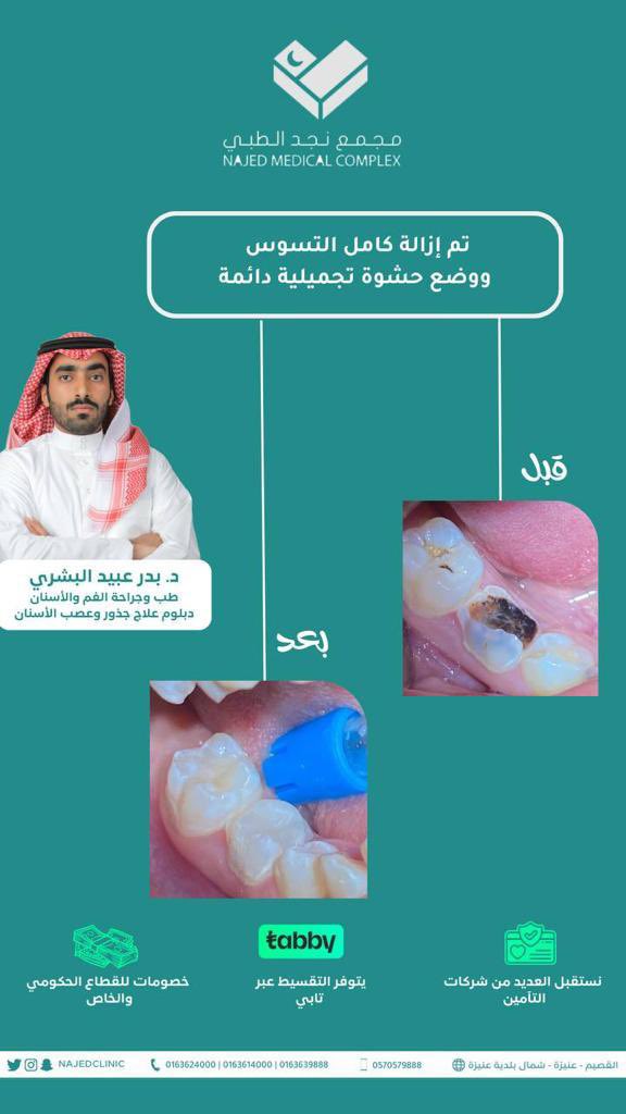 بركات شغل دكتور بدر البشري💪🏼🌷

#مجمع_نجد #القصيم #عنيزة #نجد_الطبي
#مجمع_نجد_الطبي_في_عنيزة