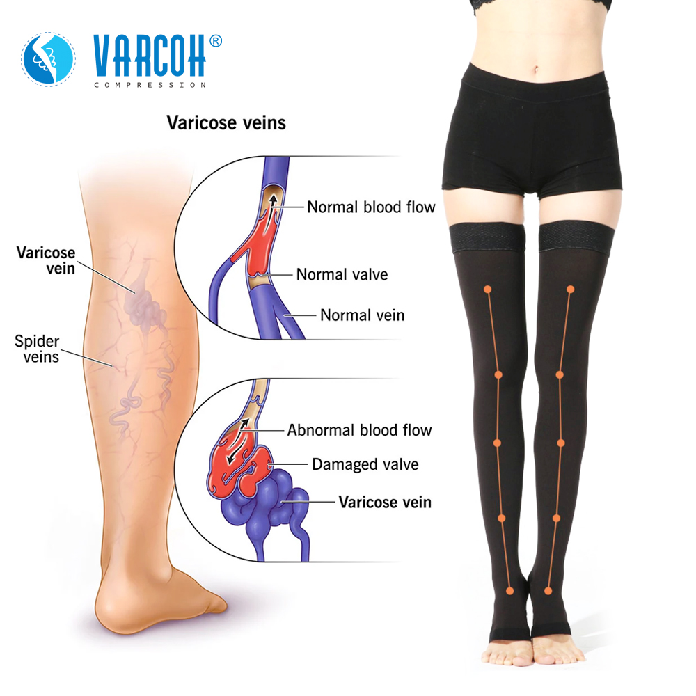 VarcohSocks's tweet photo. Varicose veins are more than just a cosmetic issue. They can be painful, and often people complain of itchiness, skin discolouration and heaviness in their legs. Varcoh Compression socks and stockings are designed for compression therapy. 
#varcoh #compressionsocks #varicoseveins https://t.co/eIrT8iRELf