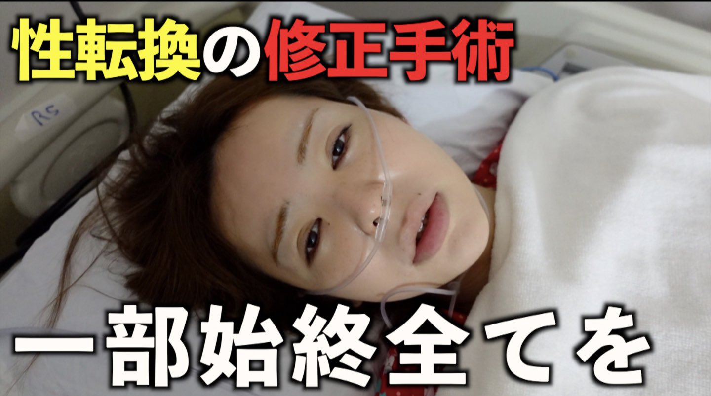性転換  / X