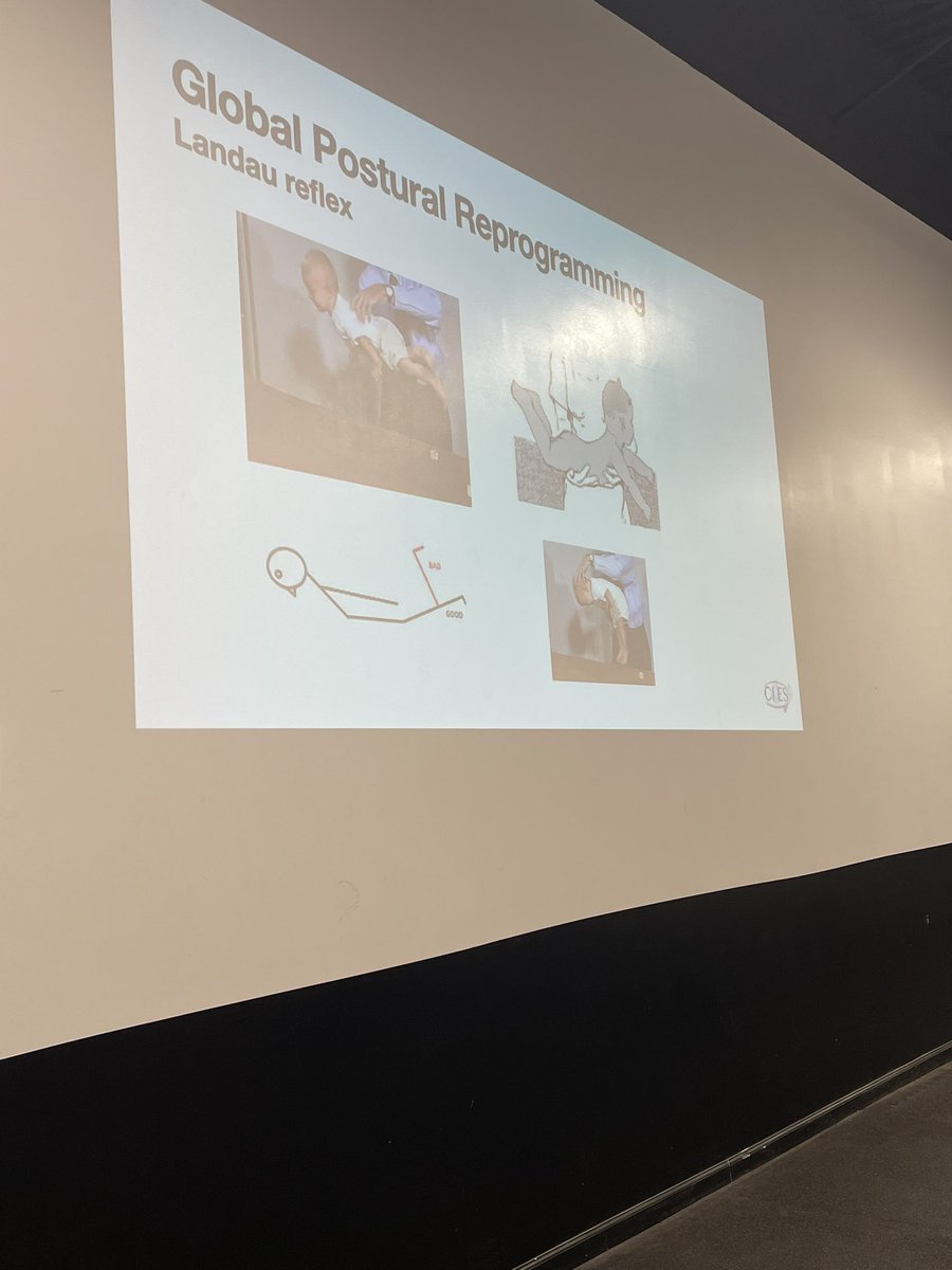 WGF1's tweet image. Getting schooled in the reflexes …..#Neurological #primitivereflexes @TFConsortium @coachbdixon @CoachFortney @korfist