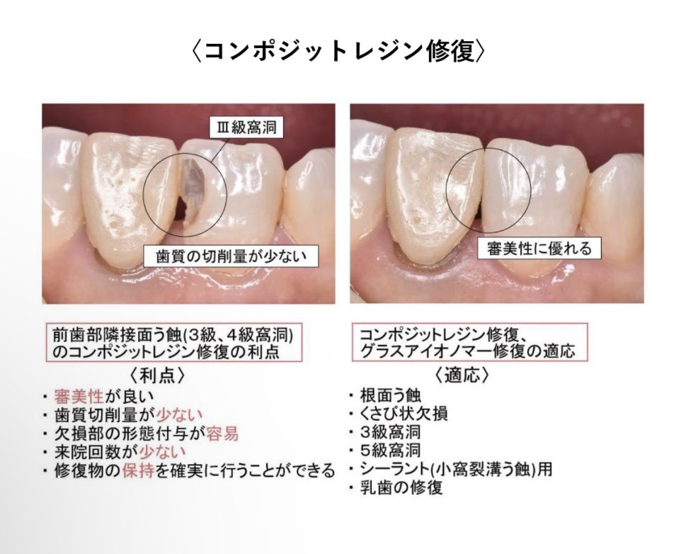 歯科のための一問一答 on X: 