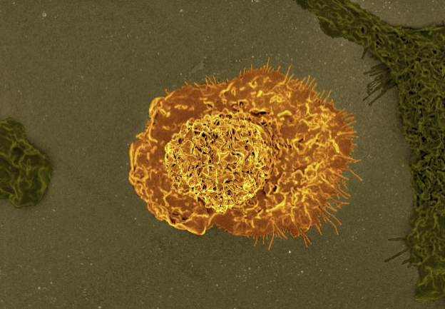 Standard_BioT's tweet photo. Don’t limit #cellprofiling to cell type data only from surface markers. #CyTOF can capture cellular regulation data - signaling, metabolism, global translational activity, chromatin content, lineage priming.
More markers in one panel, one run, one tube: https://t.co/wPDyFZFYLz https://t.co/Npy7sxePAQ