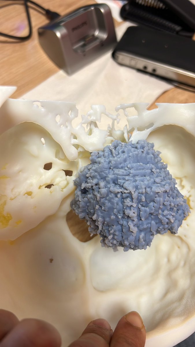 Leeds Skull Base tweet media