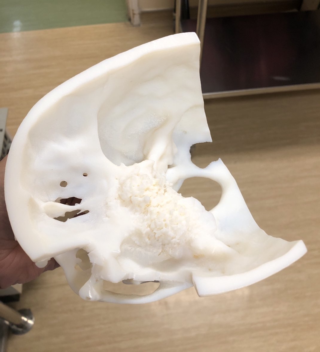 Leeds Skull Base tweet media