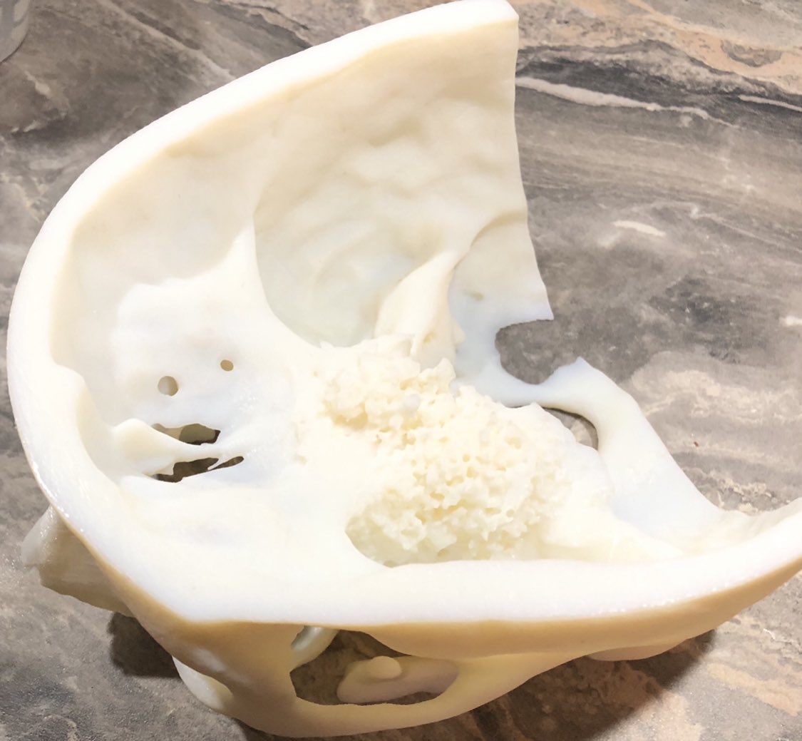 Invaluable for training and having a dry run in the lab before actual procedure. Makes complex skullbase approaches easier to figure out in OR.  <a href="/LTHTNEURO/">Leeds Neurosciences</a> <a href="/LeedsHospitals/">Leeds Teaching Hospitals</a> <a href="/The_SBNS/">SBNS</a> <a href="/e1v1m1/">BNTA</a>