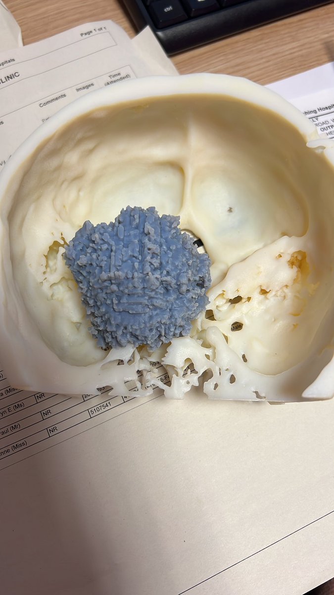 Leeds Skull Base tweet media