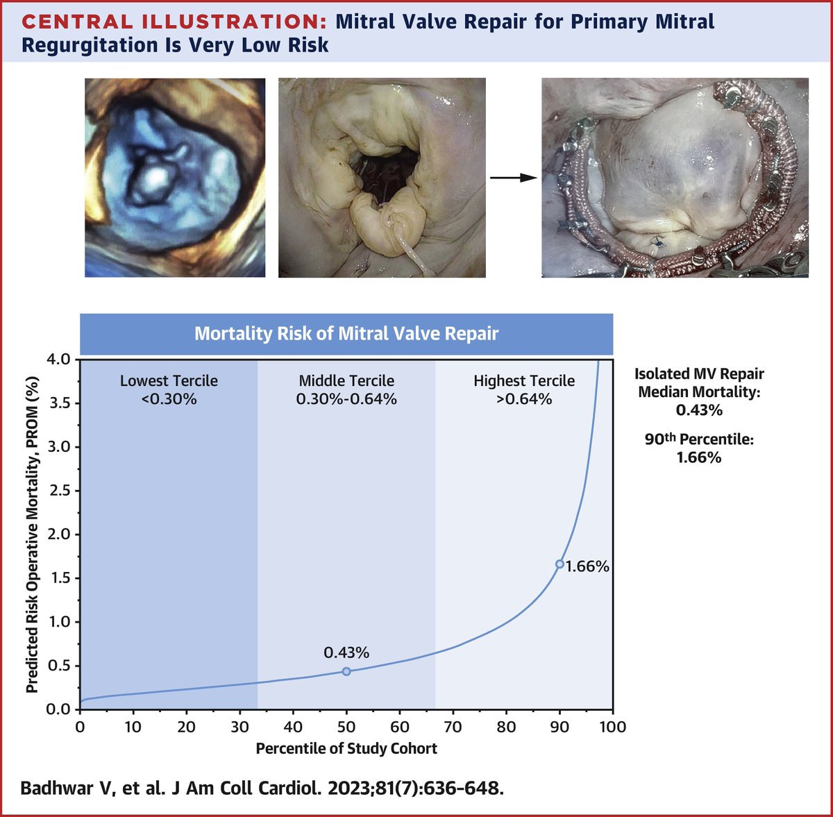 JACC Journals (@jaccjournals) on Twitter photo What is the operative risk for mitral valve repair in primary MR?
In this #JACC piece, Drs. <a href="/BadhwarVinay/">Vinay Badhwar</a>, Habib, et al work to answer this question w/ crucial findings in surgical risk assessment & understanding for #CardioTwitter clinicians everywhere bit.ly/3IuGw35 What is the operative risk for mitral valve repair in primary MR?
In this #JACC piece, Drs. <a href="/BadhwarVinay/">Vinay Badhwar</a>, Habib, et al work to answer this question w/ crucial findings in surgical risk assessment & understanding for #CardioTwitter clinicians everywhere bit.ly/3IuGw35