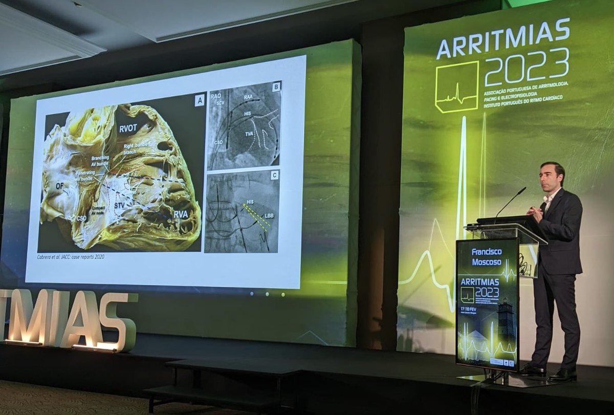Outstanding discussion on LBBA pacing and VT Ablation during joint session with @SobracO and @LAHRSonline1 at #ARRITMIAS2023 @spcardio. Great to meet our Brazilian friends. @figueiredo_ep @AlkmimRicardo @CintraDumas @dhachul_denise @Scanav1Mauricio @crpisani