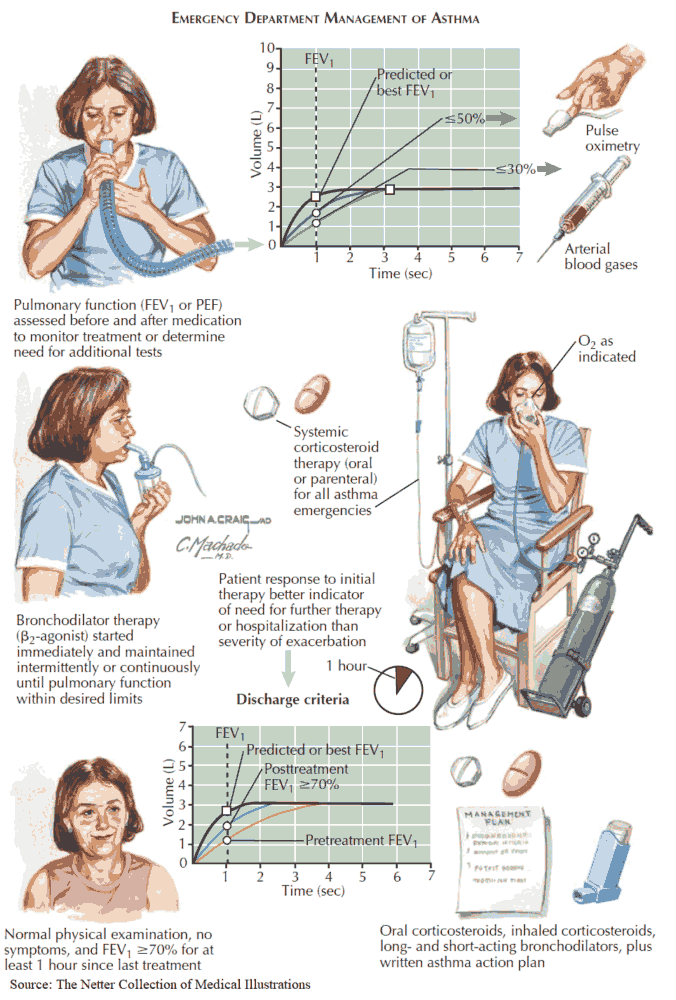 ManualOMedicine's tweet photo. Emergency Department Management of Asthma

#medtwitter #foamed #meded #medicine https://t.co/1242MRkJJu