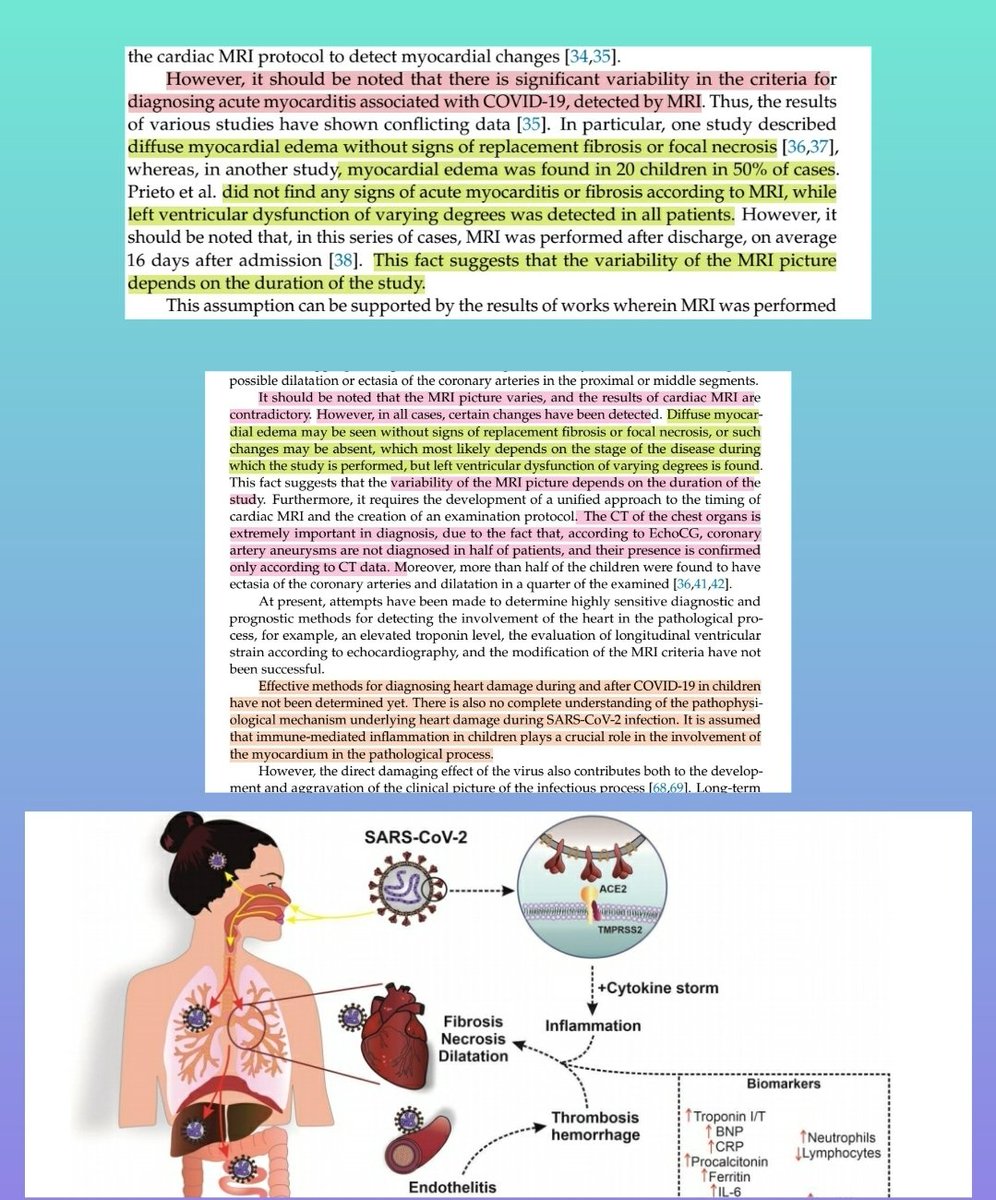 Notes showing cardiac damage in children. Inflammation of the heart's lining, necrosis in cardiac cells, as well as replacement of normal heart tissue by fibrous tissue were noted .