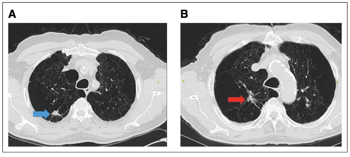 Nat Lester-Coll, MD tweet media