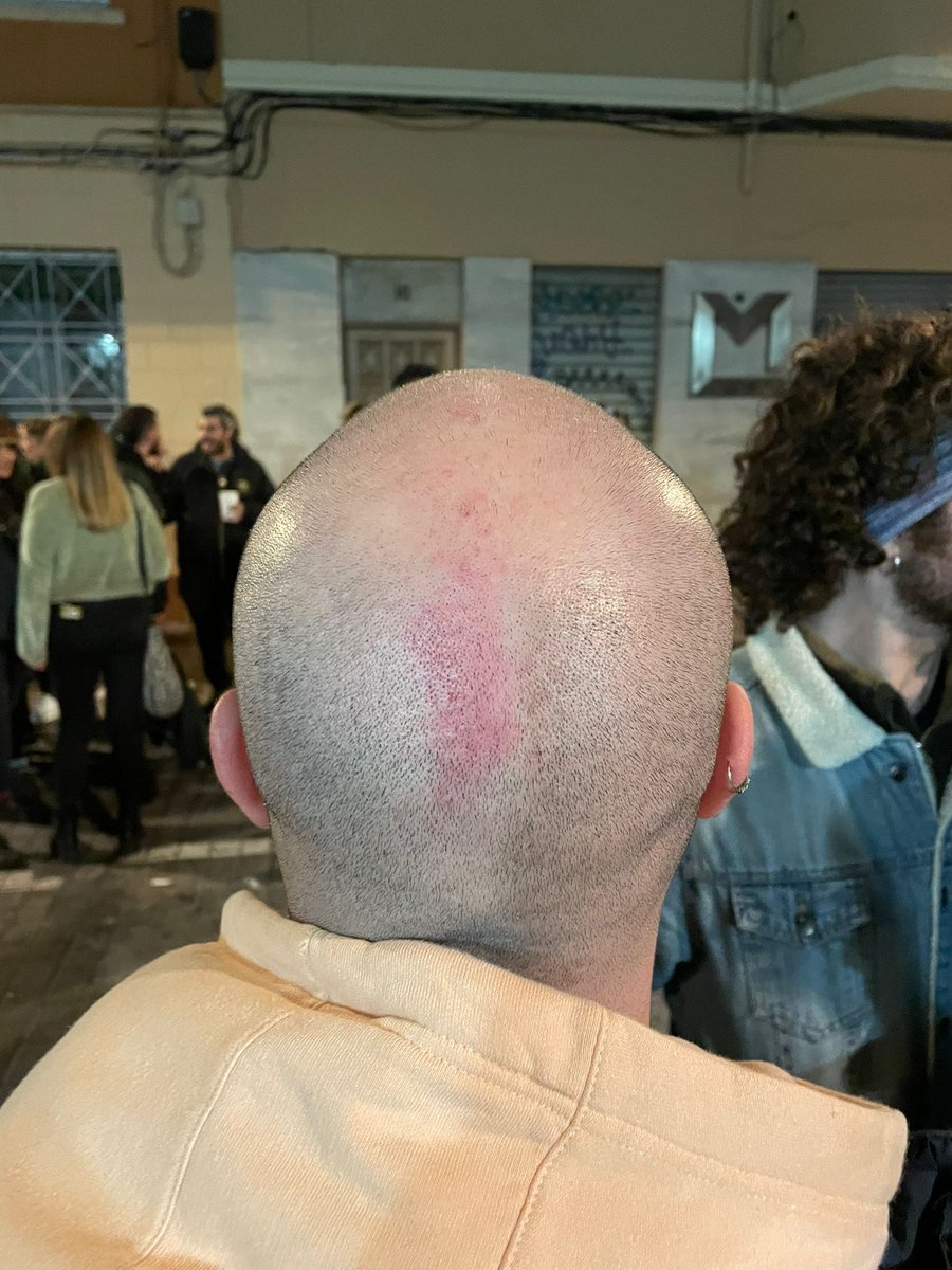 Hoy en el local "Terra"  de Benimaclet celebrábamos como todos los años un homenage a Guillem Agulló, donde nos reunimos los vecinos para festejar y reivindicar la lucha antifascista. A las 19.00 (aproximadamente) hemos sido AGREDIDOS.
instagram.com/p/Co0JS1Ltpbq/…