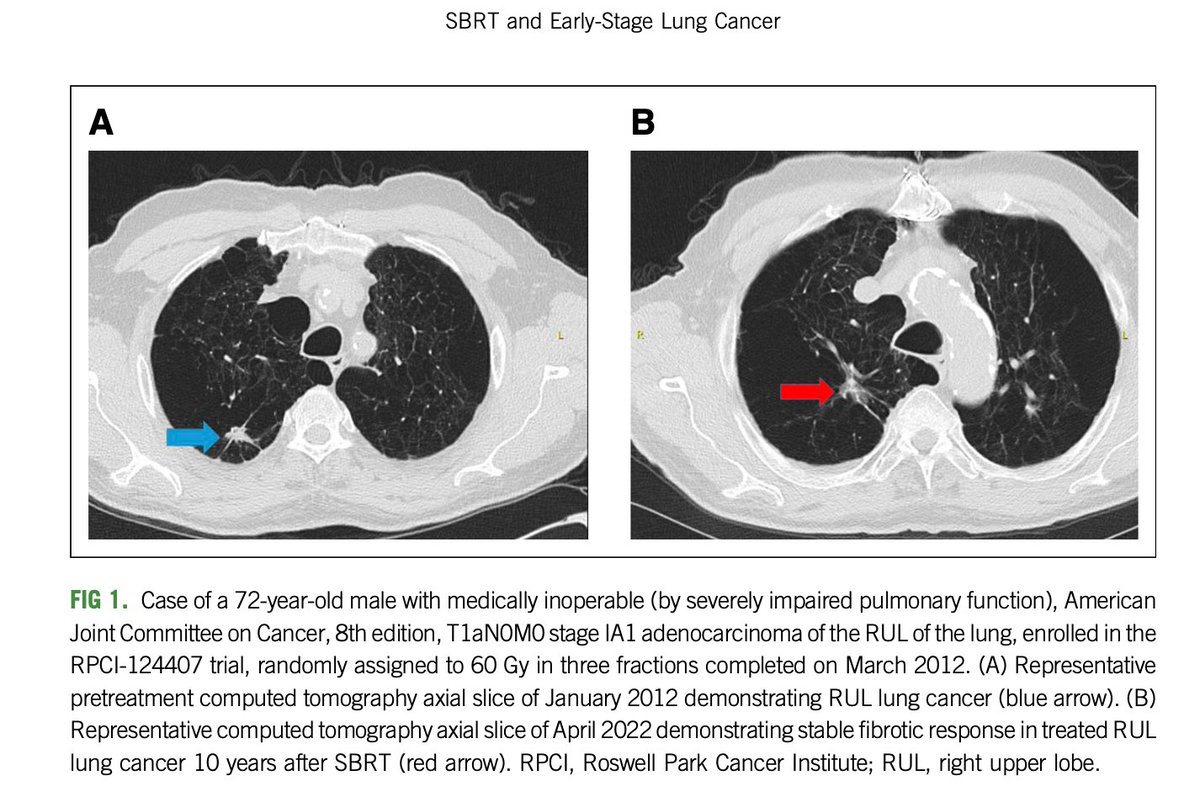 Jame Abraham, MD, FACP tweet media