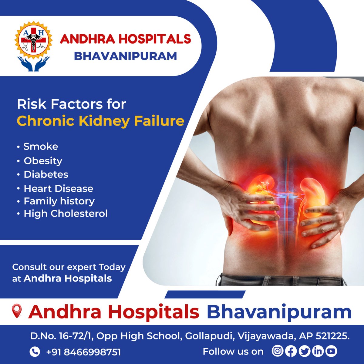 Chronic kidney disease is a condition where an individual faces the steady loss of kidney function. This is called chronic kidney failure.
#andhrahospitalsbhavanipuram #AndhraHospitals #bhavanipuram #kidneyproblem #kidneypain #kindneyfunction #kidneydisease #kidneytransplant