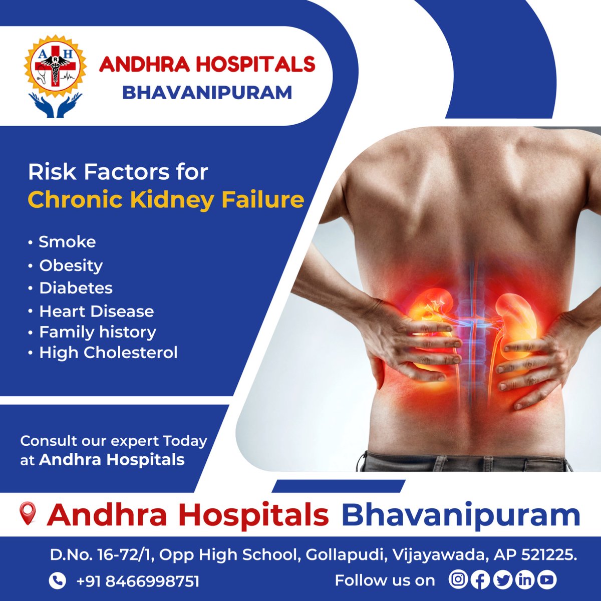 HospitalAndhra's tweet photo. Chronic kidney disease is a condition where an individual faces the steady loss of kidney function. This is called chronic kidney failure.
#andhrahospitalsbhavanipuram #AndhraHospitals #bhavanipuram #kidneyproblem #kidneypain #kindneyfunction #kidneydisease #kidneytransplant https://t.co/fM4vNOXmsR