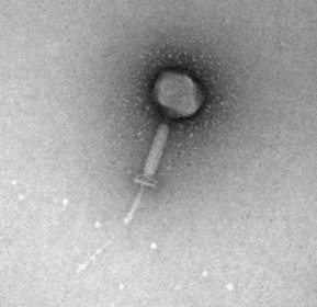 MolMicro_LAB's tweet photo. Last paper @MolMicro_LAB @iplacsic @FINBAsturias with @Inesp96 @JAEIntro_CSIC  &amp; @crodriguezlucas reporting the isolation &amp; characterization of #AMR E.faecium #phage vB_EfaH_163 active against Vancomycin &amp;Linezolid Enterococci published in @VirusesMDPI

https://t.co/9hgXNvMhNz https://t.co/k0K7zZSBGv