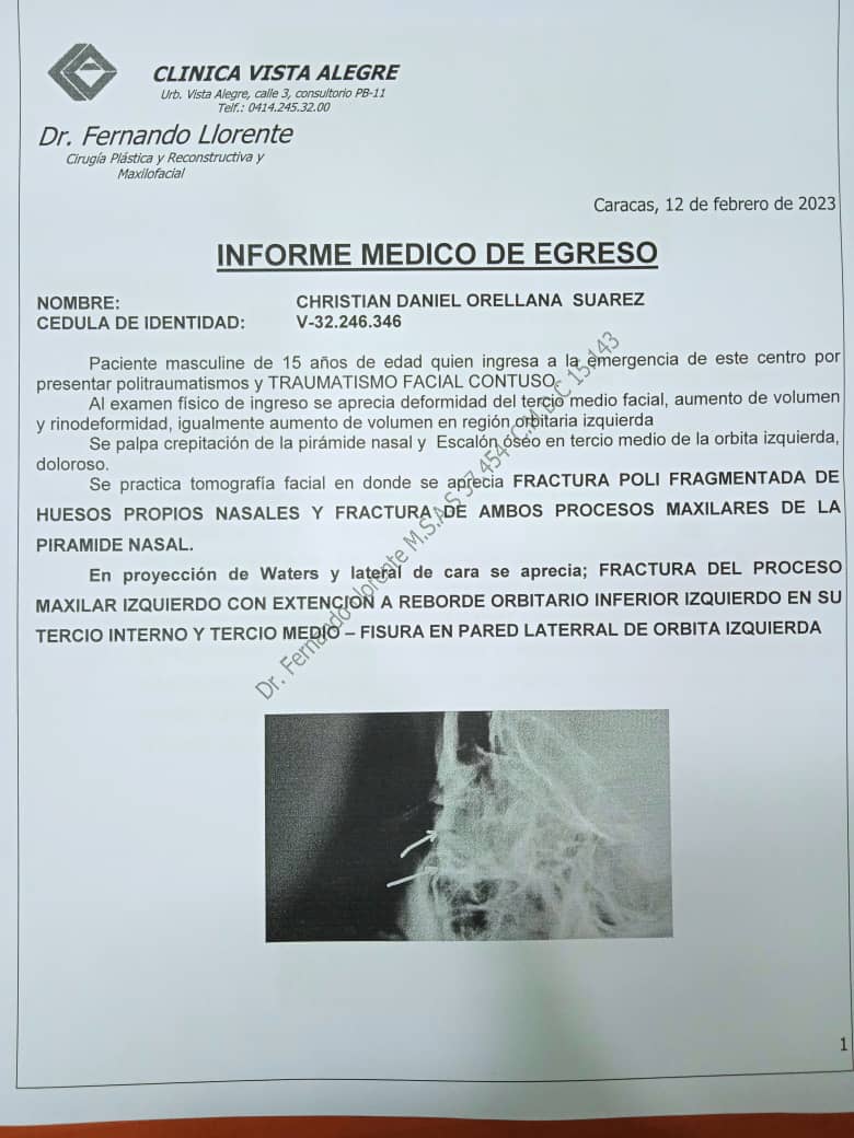 AngeTeComunica's tweet photo. En dicho Liceo " San Rafael de Pagüita" los agresores siguen haciendo su vida normal, no hubo sanción para ellos, sabiendo que el otro joven está brutalmente herido, ni preguntan cómo sigue el menor de edad. 

Vamos amigos que llegue al Fiscal para que haga Justicia por Adrián. https://t.co/Rhf9RivFz1
