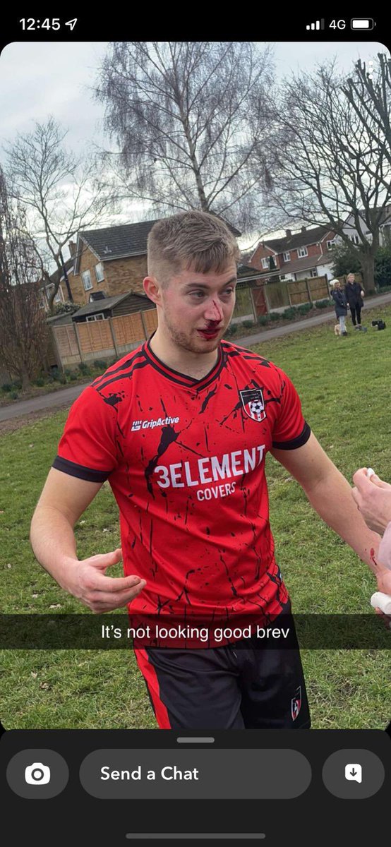 WHRoyalsFC's tweet photo. We do give him a lot of abuse, but it did have to end early unfortunately for Tom due to an elbow from a very angry Norton left back. Ran himself into the ground yet again. #UTR https://t.co/gfEHrBc2nk