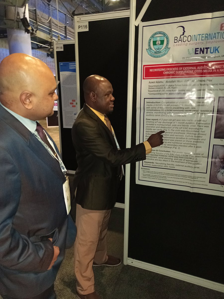 ADAMU AUWAL (@adamuauwal51) on Twitter photo It was a fantastic presentation at <a href="/BACO_ENTUK/">BACO International</a>.
From <a href="/ATBUTHINFO/">ATBUTH INFO</a> @Official_Fuhsa <a href="/ATBU_Connect/">ATBU Campus Connect</a> It was a fantastic presentation at <a href="/BACO_ENTUK/">BACO International</a>.
From <a href="/ATBUTHINFO/">ATBUTH INFO</a> @Official_Fuhsa <a href="/ATBU_Connect/">ATBU Campus Connect</a>
