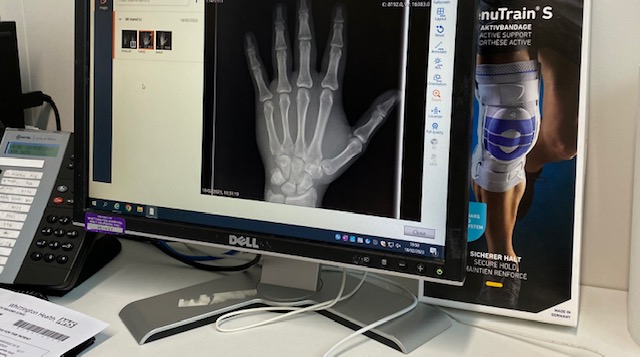 MJcomp86's tweet photo. After working on couple of AI projects in healthcare, I realise how crucial is patent feedback for imporving services.
My unfortunate bike accident took me to Whittington hospital yesteday. Although it was a busy weekend, I was visited by a GP and x-rayed in less than 10 min #NHS https://t.co/KqVC4cBpu2