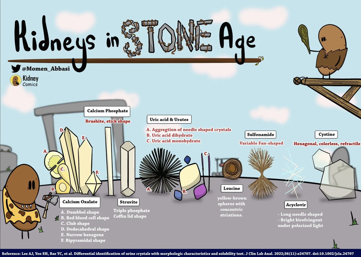 New addition to #MedComics by @Momen_Abbasi 'Kidneys in Stone Age' nephsim.com/medicine-comic… #UrineMicroscopy 💎 images: nephsim.com/urine-gallery/ #FOAMed #Nephrology @jrseltzer @JoseTesser