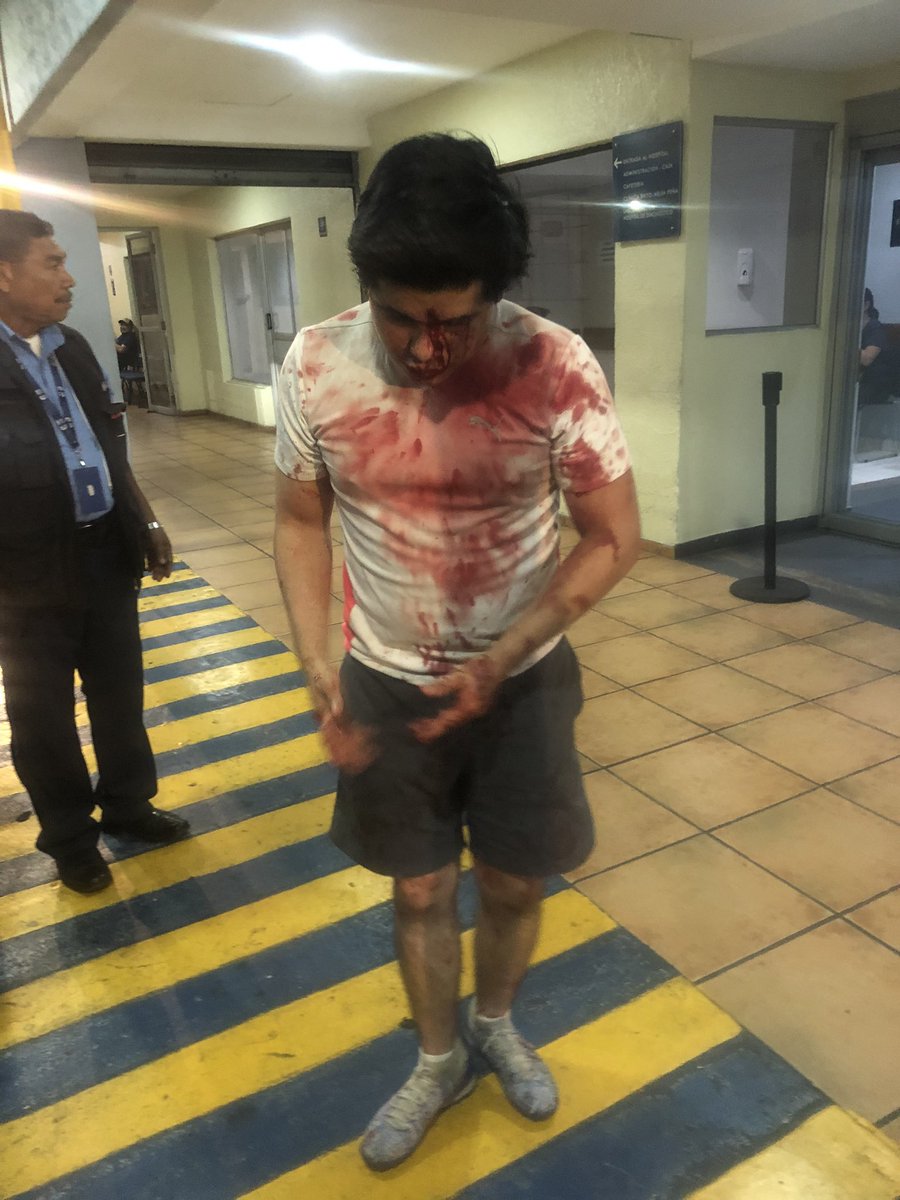 GeoGonzalezES's tweet photo. Hijo de productor de TCS y su novia ambos estudiantes de la Universidad Matías Delgado vapulean a joven por partido de fútbol. 

Estos sujetos fueron invitados a un partido amistoso de fútbol y este muchacho violento llamado Diego Oviedo golpeó a Christian a Muerte. SIGUE ⬇️ https://t.co/AgVDWqbbmN