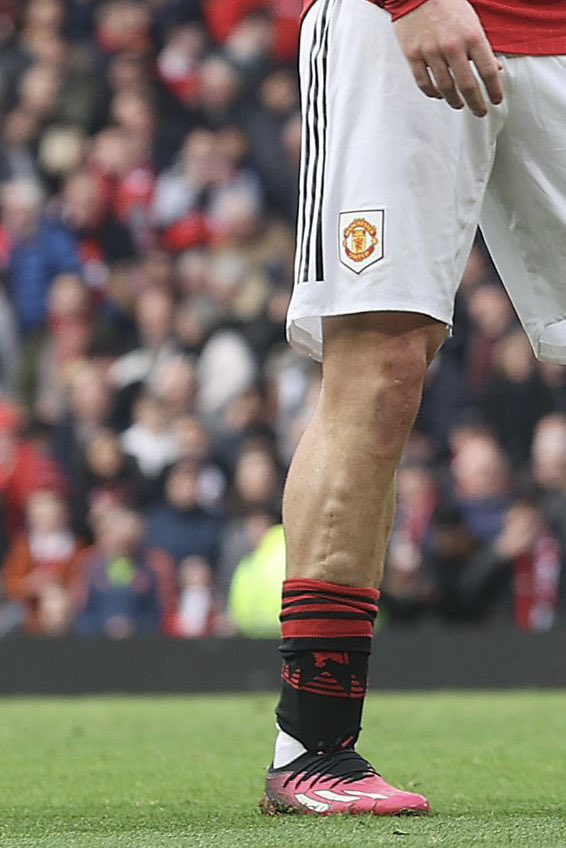 UtdPlug's tweet image. ❤️ Truly crazy when you see this picture and the fact Luke Shaw has bounced back from double leg break, 𝐖𝐡𝐚𝐭 𝐚 𝐩𝐥𝐚𝐲𝐞𝐫! 

📸 @CasemiroBall