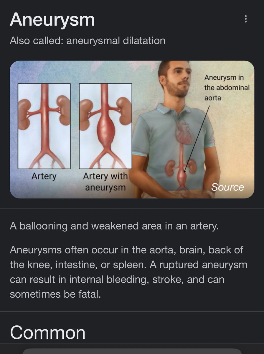 Lilulicious's tweet image. Aneurysms: definitely not blood clots. Antivaxxers: definitely fucking morons. This person could give a fuck about Tom Sizemore, they just want to score points on their political agenda. Because they care so much. May they meet the end they so richly deserve. #DarwinAwards