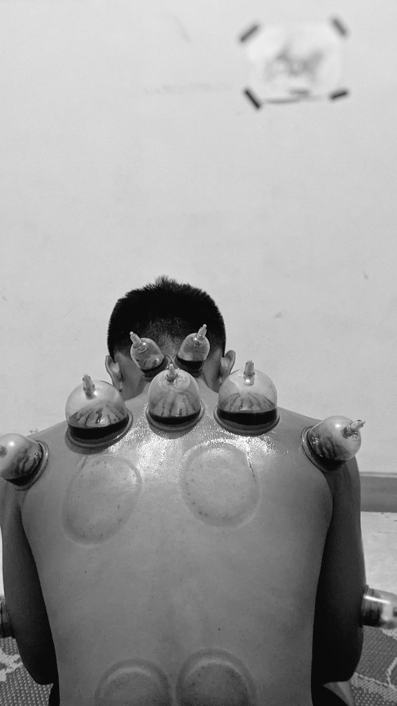 setiawanpijat's tweet image. #pijatpanggilansolo
#pijatnogay
#pijatpriadanwanitasolo
#pijatwanitasolo
#pijatsolo
#terapispriasolo