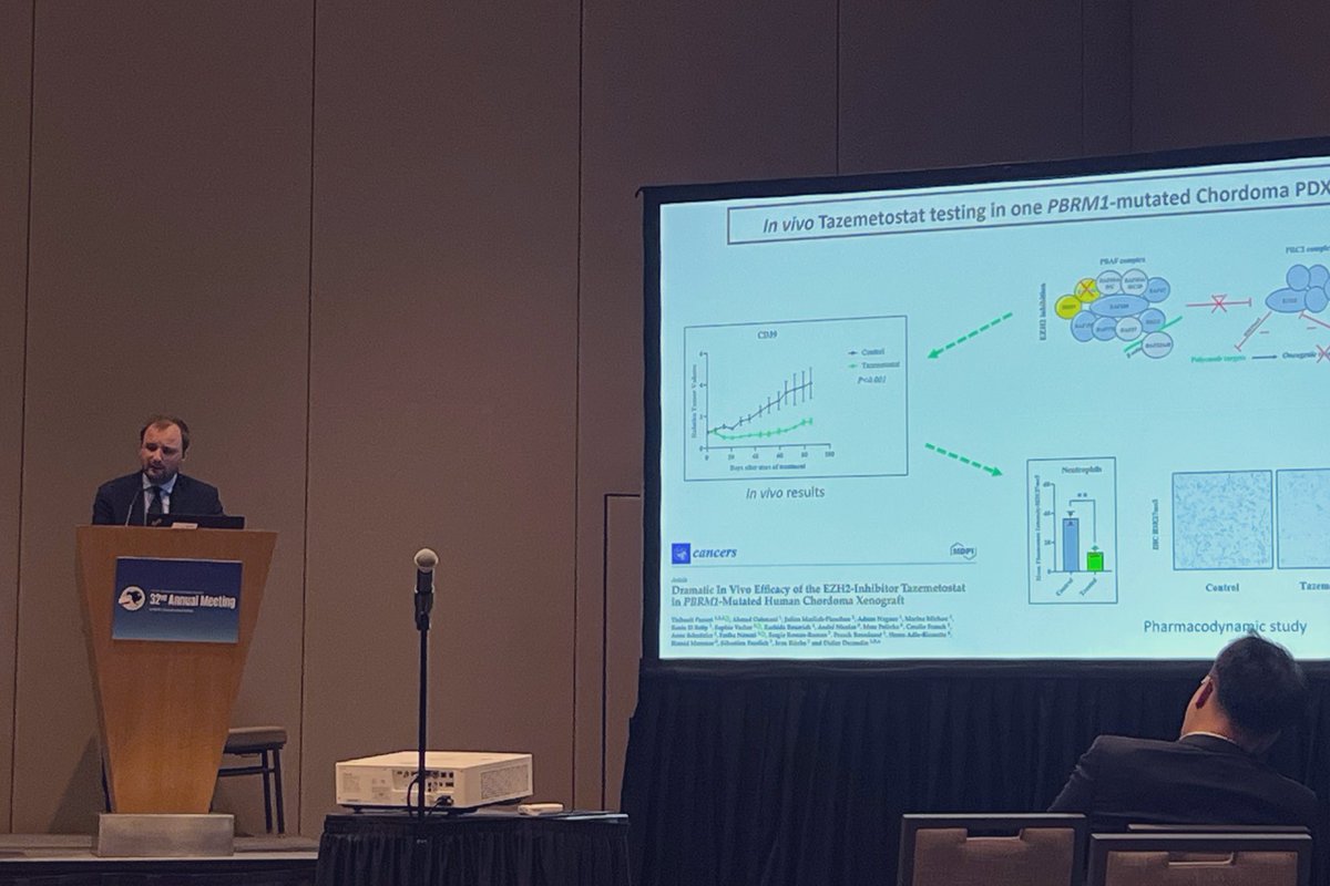 SC_Froelich's tweet photo. Proud of our young partner @ThibaultPasseri  who received the #NASBS2023 Fred Gentili clinical excellence award for his work on the mutational landscape of skull base chordomas. Thanks to @NASBSorg. Thanks to our research team ! @chordome_org @ChordomaFDN @HopLariboisiere @TheJNS https://t.co/f49Pu2O6SB