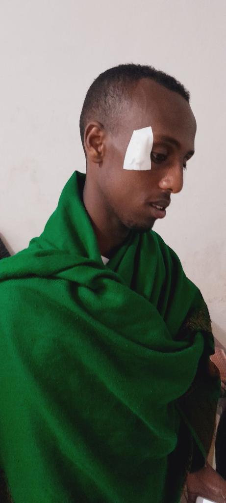 Mohamme15748622's tweet photo. ዛሬ በነቀምት ሙስሊሞች ላይ መስጅድ ውስጥ ድንገተኛ ጥቃት በውሀብያ ቡድን ደርሶል 🥺
ጉዳት የደረሰባቸው ወንድሞቻችን መስጅዱን ለወራሪ ውሀብያ አሳልፈን አንሰጥም በማለታቸው ነው አላህ ይጠብቃቸው💪
ይህ የሀገር ጉዳይ ነው ነገም በእኔ በል ወገኔ🇪🇹💔 https://t.co/XV7pYLSPRQ